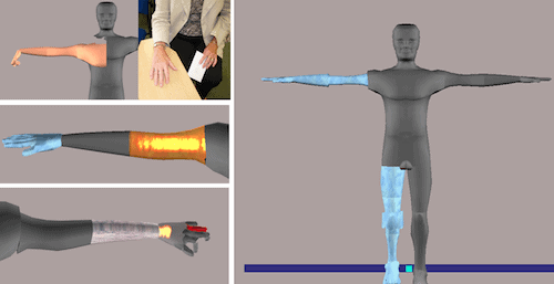 Examples of body perception in stroke