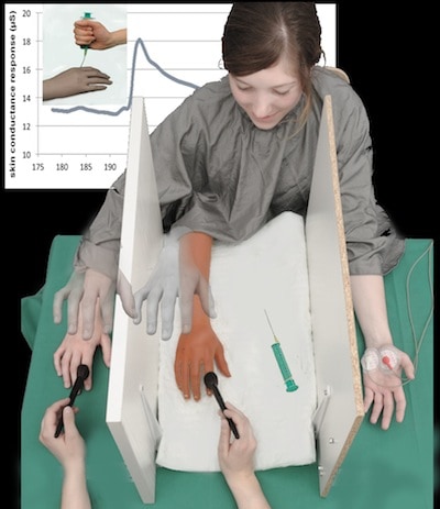 Preserved ability to integrate a rubber hand indicates intact multisensory  integration in CRPS - International Association for the Study of Pain (IASP)