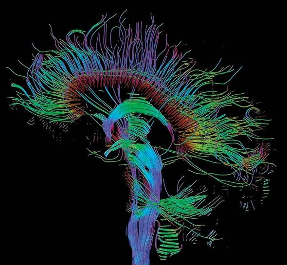 magnetic-resonance-imaging-MRI