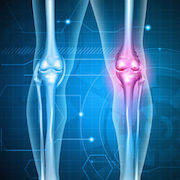 Knee pain abstract background. Healthy joint and unhealthy painful joint with osteoarthritis.