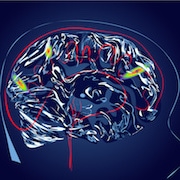 brain scan abstract illustration. Magnetic resonance imaging of the brain