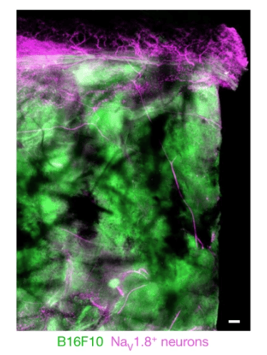 Figure 1A Cancer Immunosurveillance