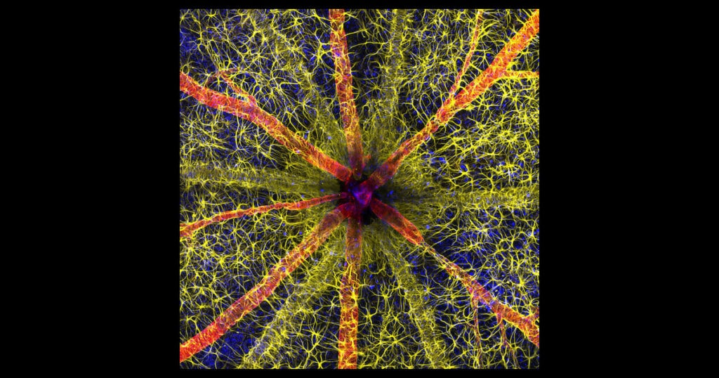 Rodent Optic Nerve